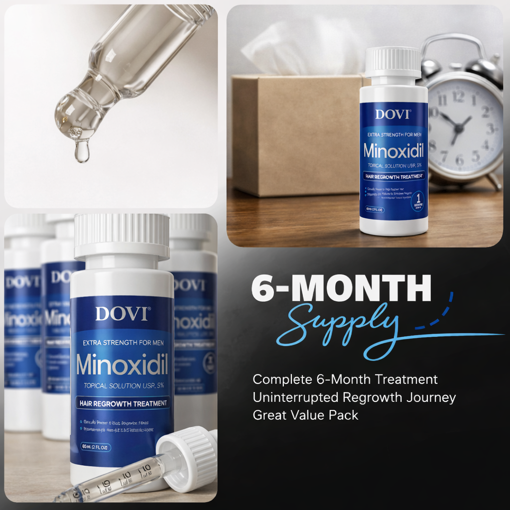 Dovi Minoxidil 5% Hair Regrowth Treatment for Men – Extra Strength Topical Solution, 6 Month Supply